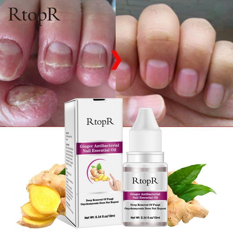 Óleo Anti-Bacteriano e Anti-Micótico para Unhas - RtopR®