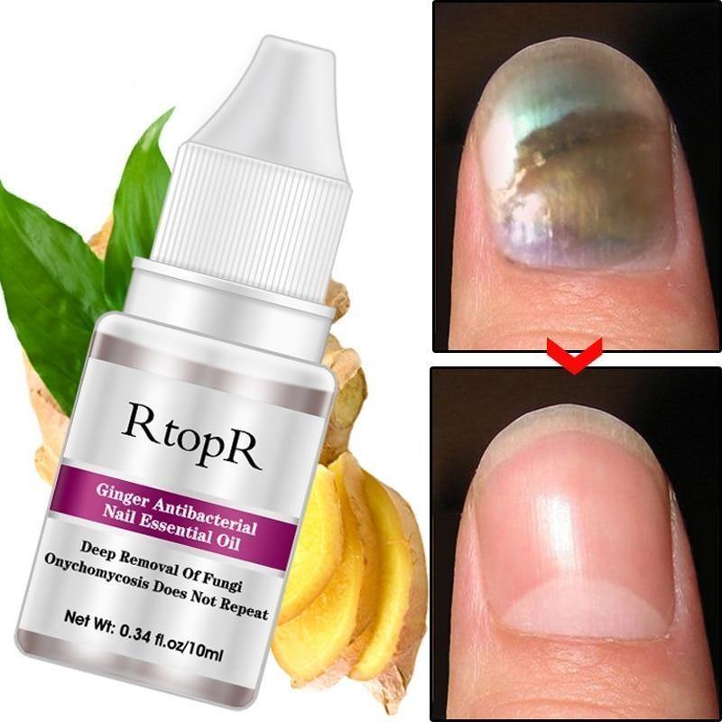 Óleo Anti-Bacteriano e Anti-Micótico para Unhas - RtopR®