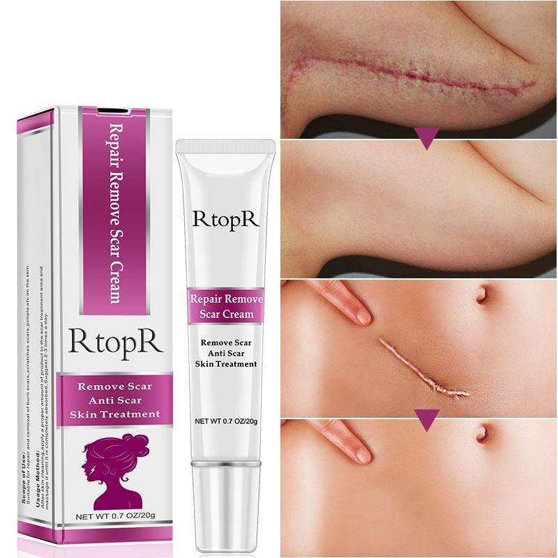 Creme Rejuvenescedor Removedor de Cicatriz - RtopR®